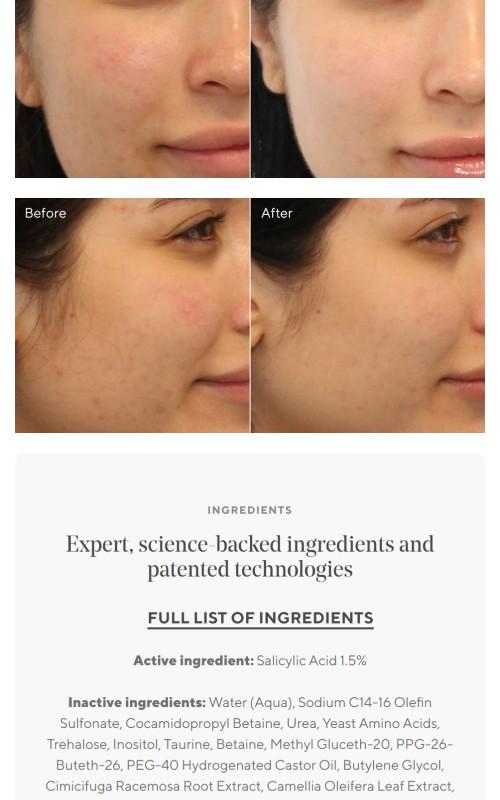 Acne Control Clarifying Cleanser