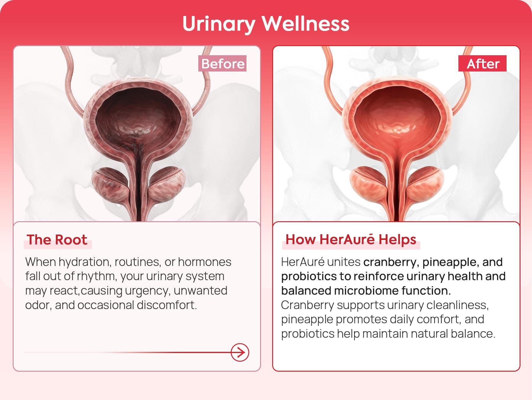 HerAuré Women’s Probiotics - pH Balance, Odor Control, Flora Health, Moistening, Tightening - With 7 Billion CFU Probiotic, Prebiotic, 7-in-1 Mushroom Blend, Cranberry, Pineapple - 60 Capsules (Pack of 1), Self-Care Gift,Black Friday HerAuré Women’s Probiotics - pH Balance, Odor Control, Flora Health, Moistening, Tightening - With 7 Billion CFU Probiotic, Prebiotic, 7-in-1 Mushroom Blend, Cranberry, Pineapple - 60 Capsules (Pack of 1), Self-Care Gift,Black Friday