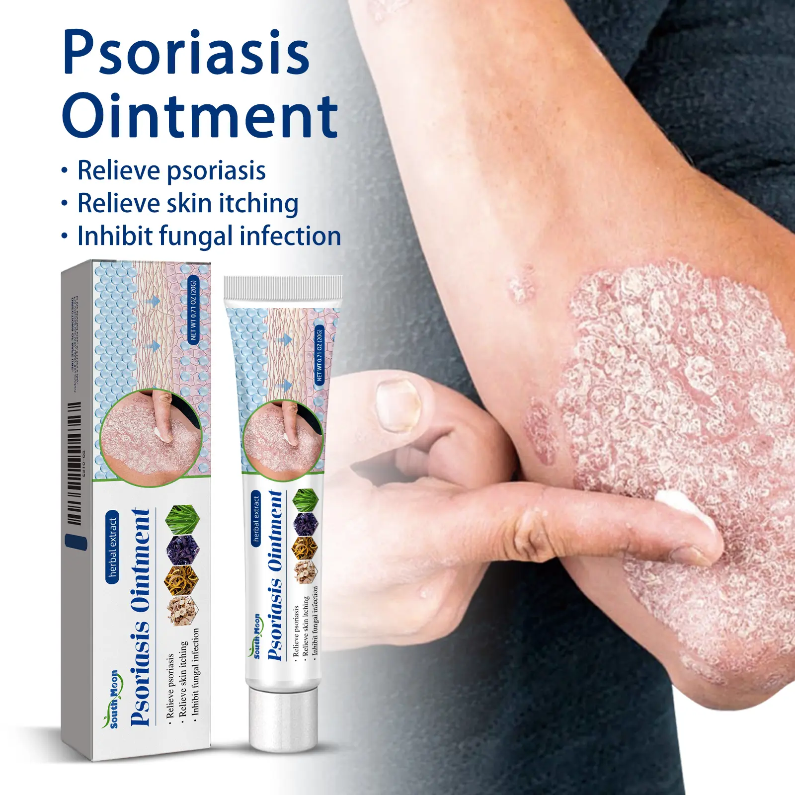 All-Natural Soothing Antifungal Cream | Plant-Based Treatment for Ringworm & Jock Itch | Gentle Relief for Eczema, Psoriasis & Rashes | Fast-Acting Skin Repair Formula