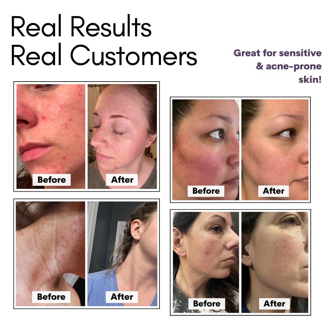 Tallow Face Cream & Body Butter - Nourishing Moisturizer, Hydrating Anti-Aging Skincare, Soothing & Repairing Daily Lotion Sensitive Smoothing