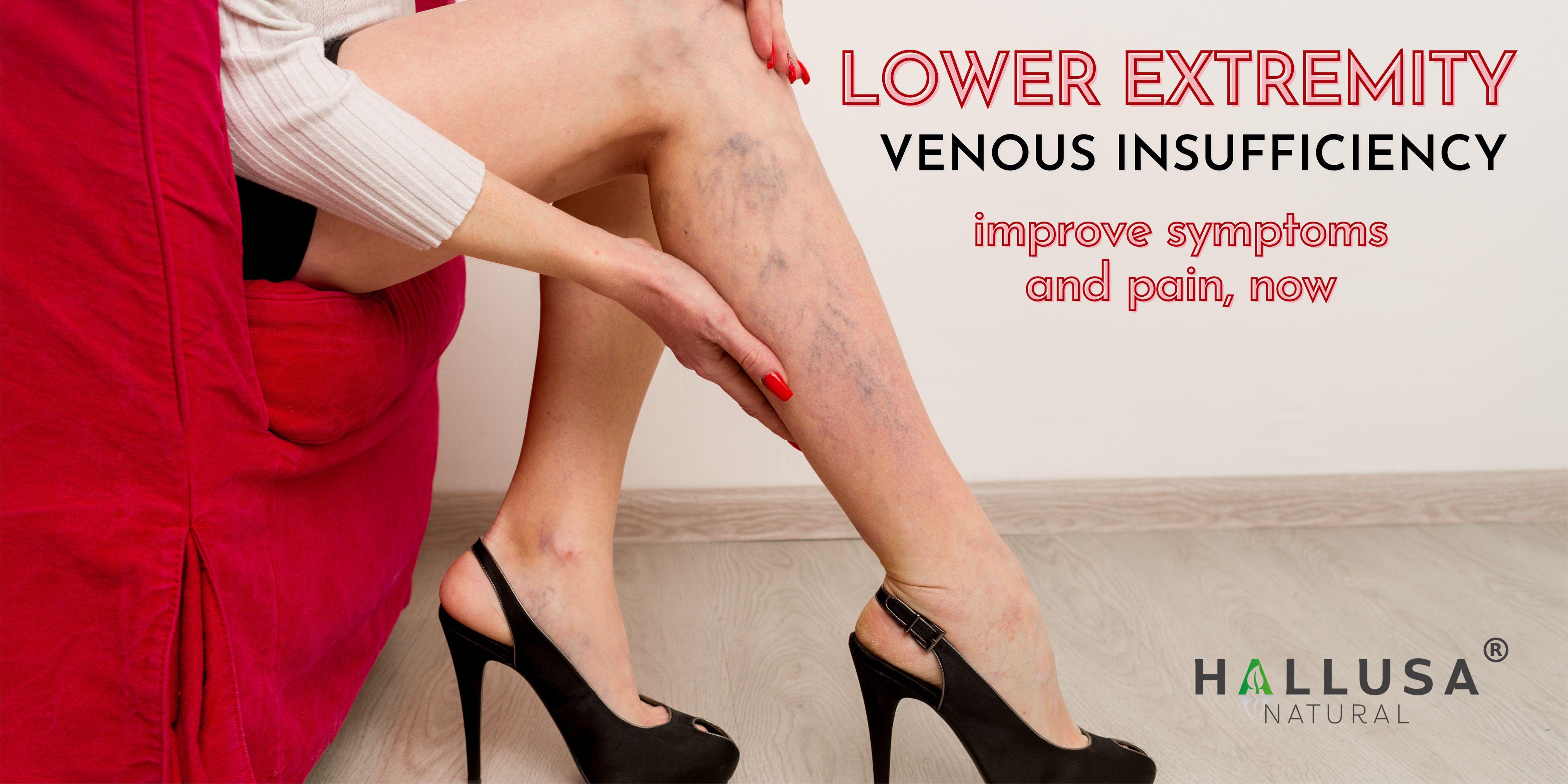 HALLUSA NATURAL HALLOSMINE 300 Mg Diosmin Circulation 60 Capsules Gluten-Free Organic GMO-Free Sugar-Free Supplement for Healthy Circulation & Veins Health Made in USA Dietary HALLUSA NATURAL HALLOSMINE 300 Mg Diosmin Circulation 60 Capsules Gluten-Free Organic GMO-Free Sugar-Free Supplement for Healthy Circulation & Veins Health Made in USA Dietary