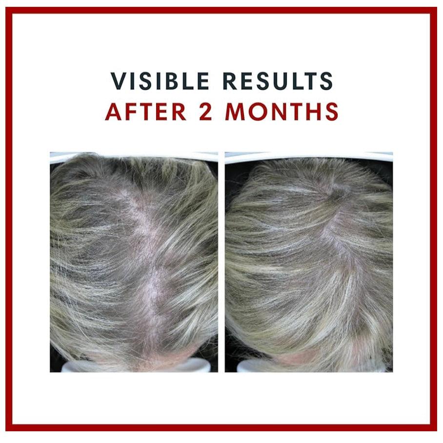 Biotin Gain Gummies - 60 Count, 10,000 mcg Biotin, AnaGain Extract, Strawberry Flavor, Dietary Supplement for Hair & Nail Health