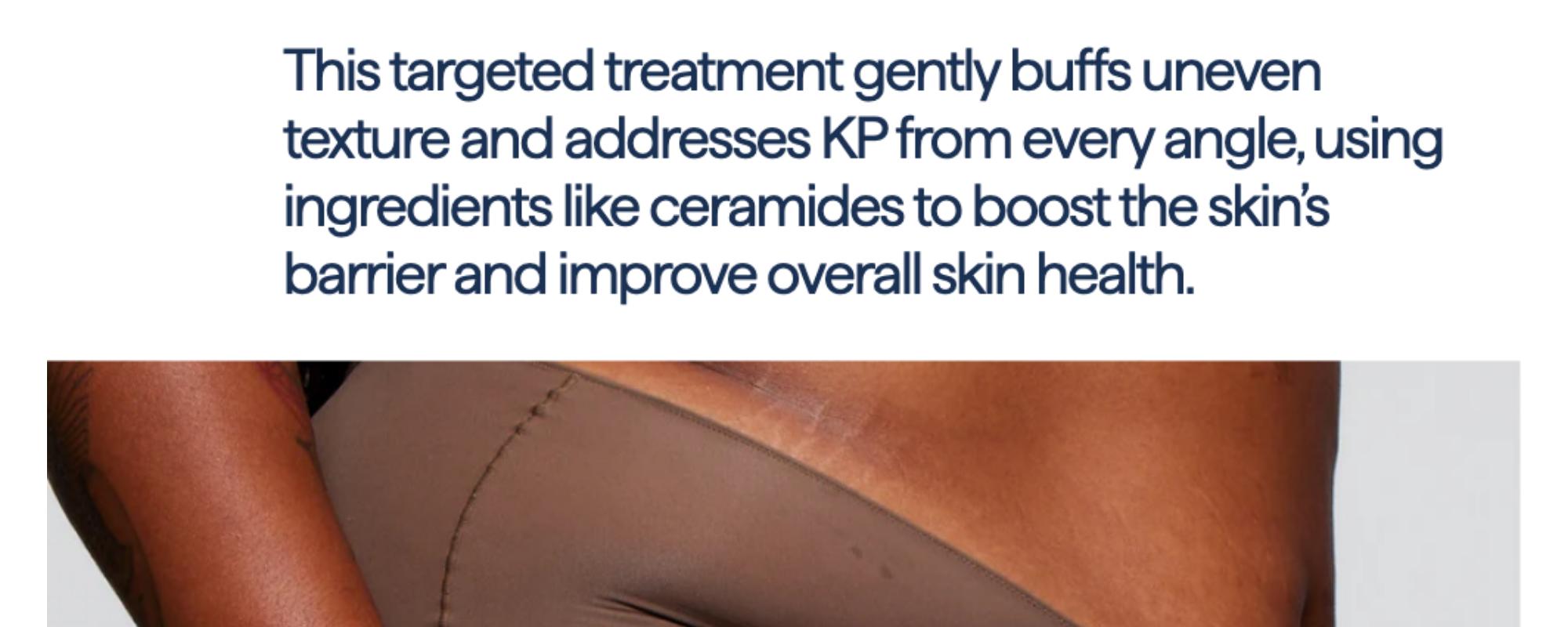 REMEDY KP Exfoliating Body Moisturizer - New Size: 7.7 Fl Oz.