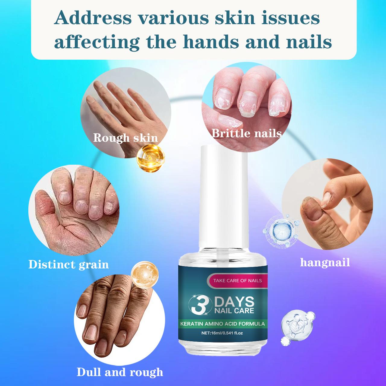 ROZINO 3 Days Nail Care Formula with Keratin Amino Acid & Aloe for Superior Nail Nourishmen.for Healthy Nails Professional Multi-Benefit Treatment ROZINO 3 Days Nail Care Formula with Keratin Amino Acid & Aloe for Superior Nail Nourishmen.for Healthy Nails Professional Multi-Benefit Treatment