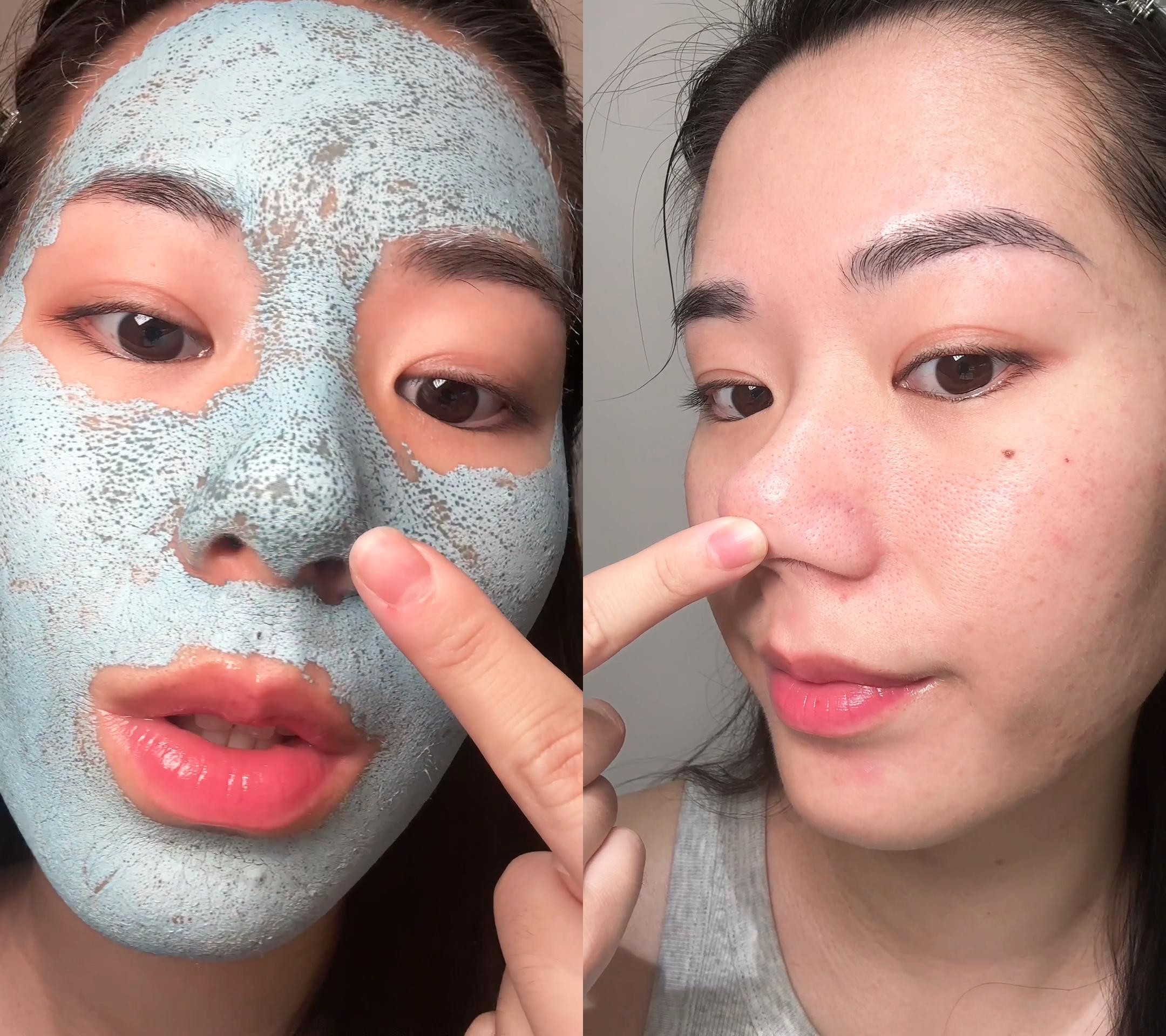 Medicube Zero Pore Blackhead Mud Mask