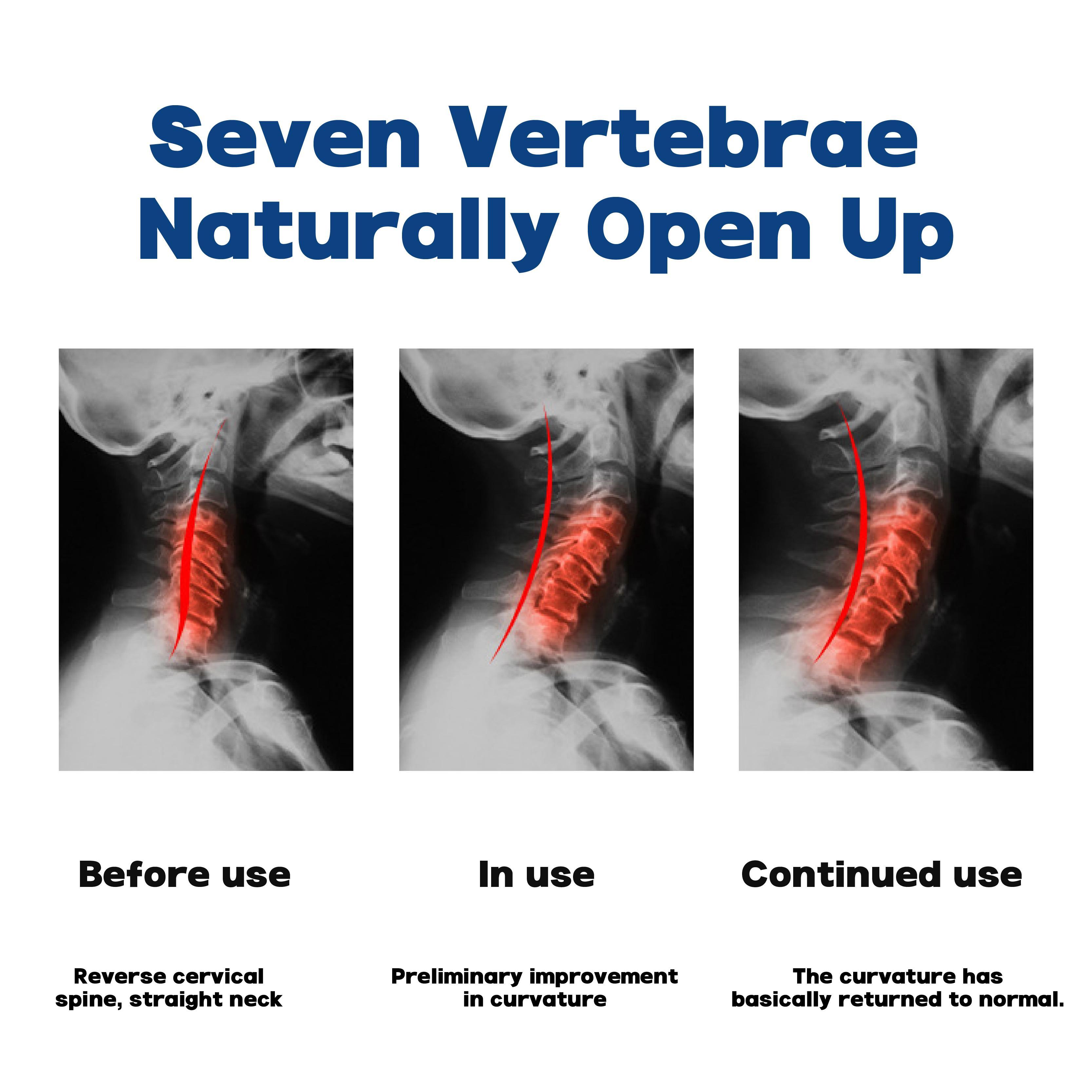 Cervical Massage Pillow Portable Gravity Acupressure Neck Correction Neck Support Sleep Repair Traction Pillow Body Care Therapy Home Spa Equipment Blue