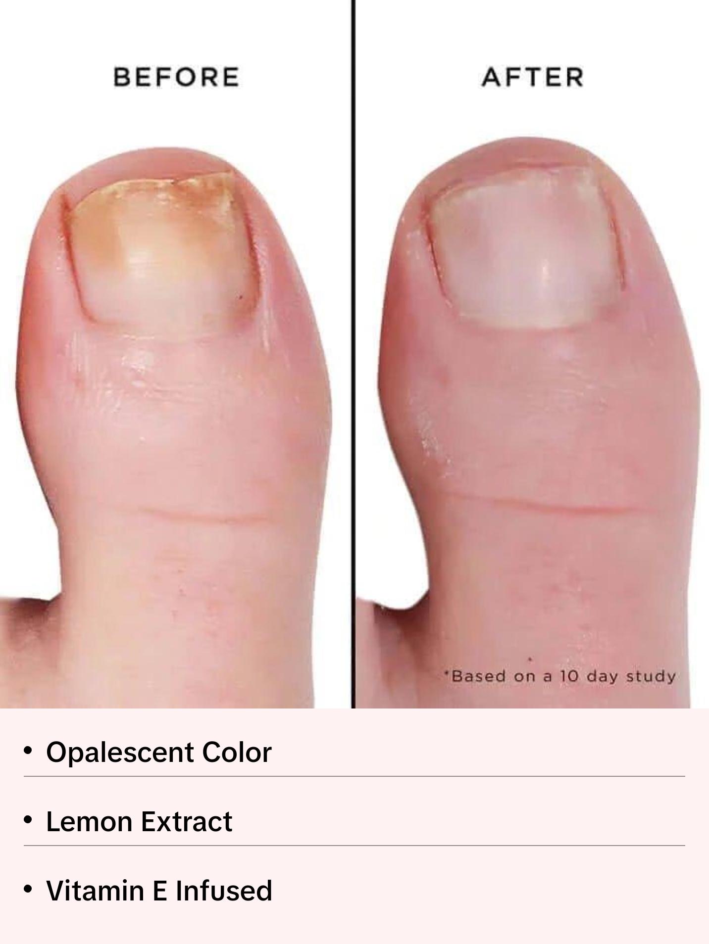 Mellow The Yellow Nail Brightening Treatment, 0.2 fl oz Mellow The Yellow Nail Brightening Treatment, 0.2 fl oz