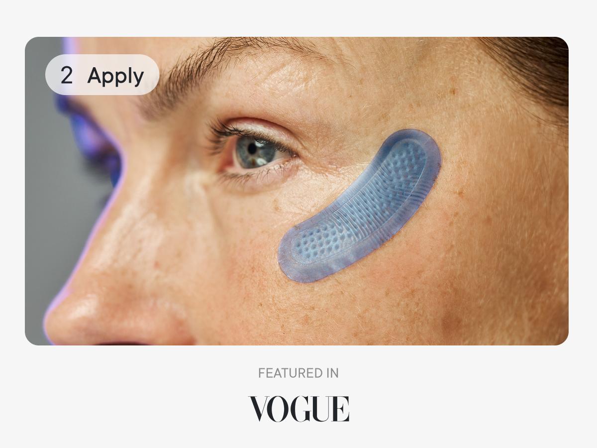 Qure Micro-Infusion Anti Wrinkle Patches for Smile Line, Frown lines, Under Eye Bags, Puffiness, Crow's Feet - Retinol, Niacinamide, Caffeine, Peptides - Dissolvable for Overnight Use - 8 Pairs