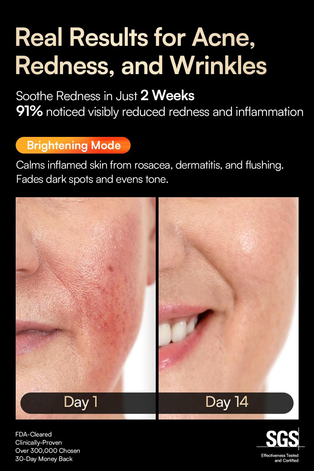 【LIVE EXCLUSIVE】INIA GLOW Wireless LED Face Mask, 2-Year Warranty, Portable and Rechargeable for LED Facial Mask Skincare at Home and Travel, The Ultimate Gift Choice for this Season