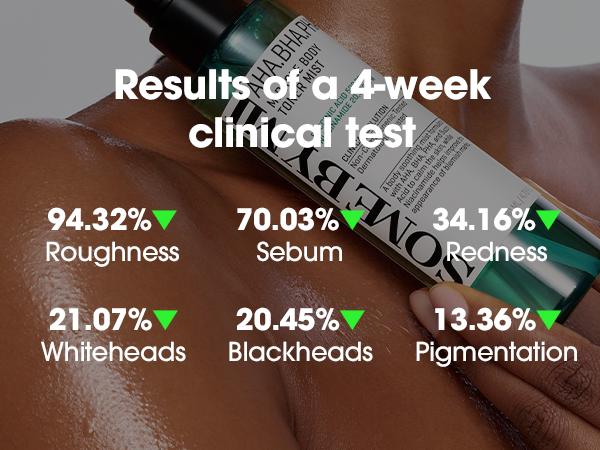 Body Acne Treatment Set - AHA BHA PHA & Niacinamide Kit to Fade Dark Marks, Hyperpigmentation & Body Odor - Clear Skin Routine - Korean Skincare