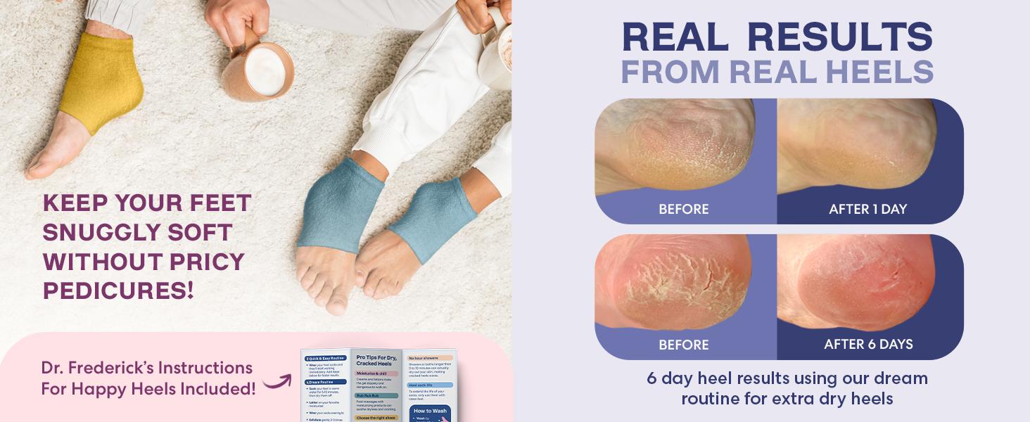 Dr. Frederick's Fuzzy Moisturizing Heel Socks - Soften Dry Cracked Heels Overnight
