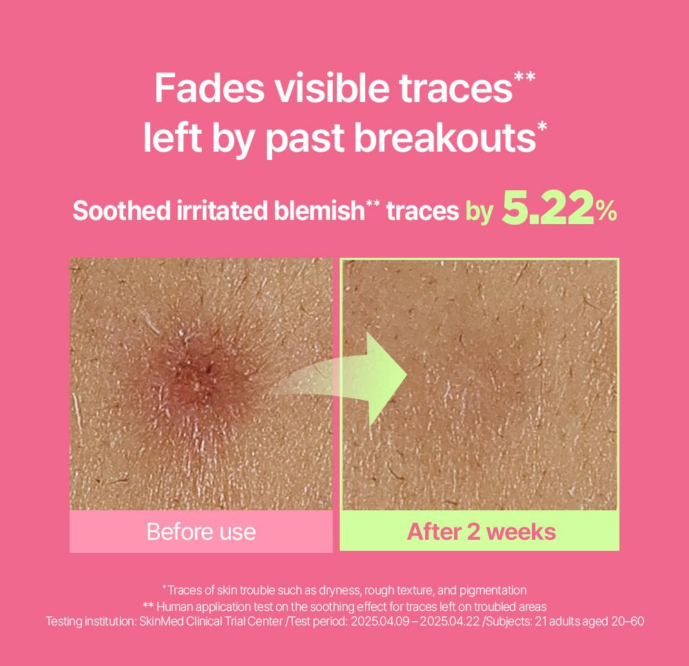 [BeginS by JUNGSAEMMOOL] Pink Guava Glutathione Blemish Serum - Korean Facial Serum with 10% Niacinamide, Vitamin C-rich Jeju Guava for Dark Spot Care, Radiant Glass Skin (1.01 Fl Oz)