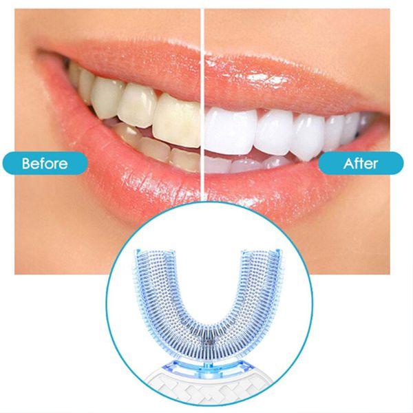 ABS Electric Dual-Color Rechargeable Sonic Rotating Couple Set Tooth Cleaner Smart Teeth Whitener with Intelligent Timer & Quadrant Reminder for Efficient Cleaning