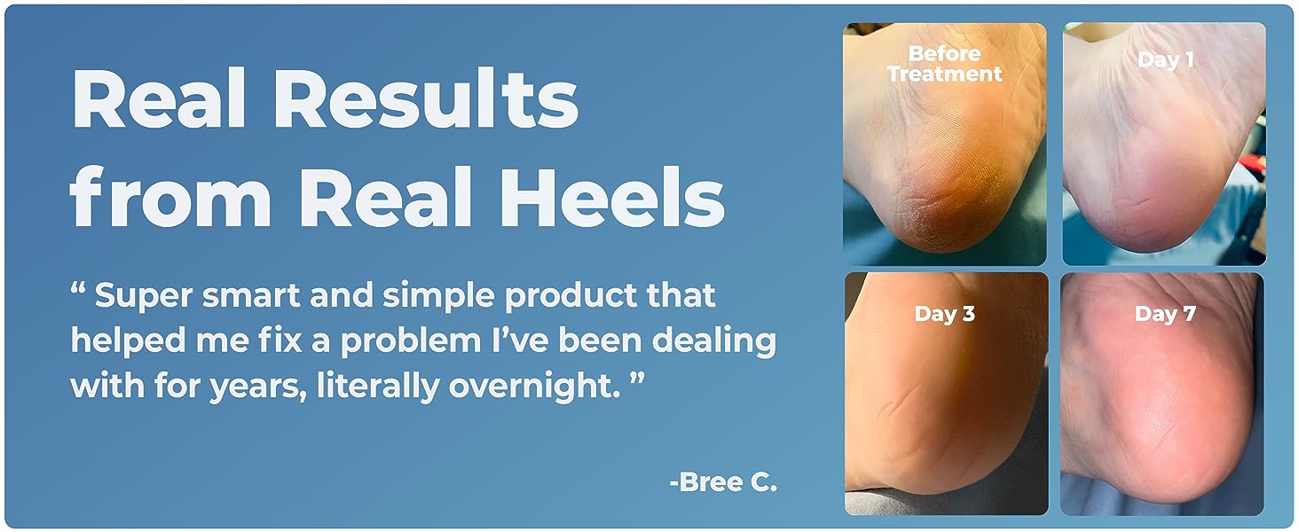 Dr. Frederick's Moisturizing Heel Socks - Cracked Heel Relief - 2 Pairs
