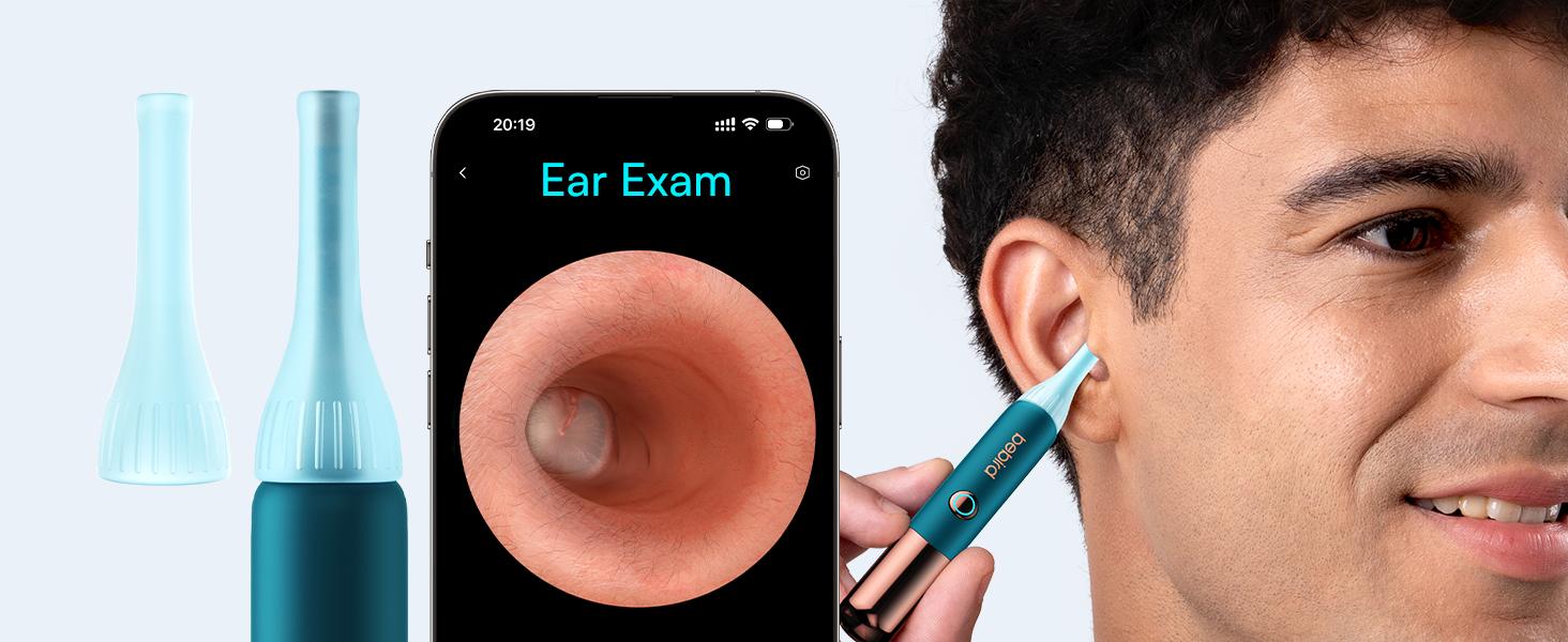 【Theatrical-Grade】Bebird Earsight Ultra Ear Wax Removal Tool , Ear Cleaner with Flexible Ear Camera Otoscope, Painless Visual Ear Pick Tweezers, Visual Scope Earwax Cleaning Dropper, Ear Cleaning Kit for Family