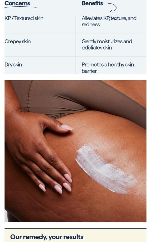 REMEDY KP Exfoliating Body Moisturizer - New Size: 7.7 Fl Oz.
