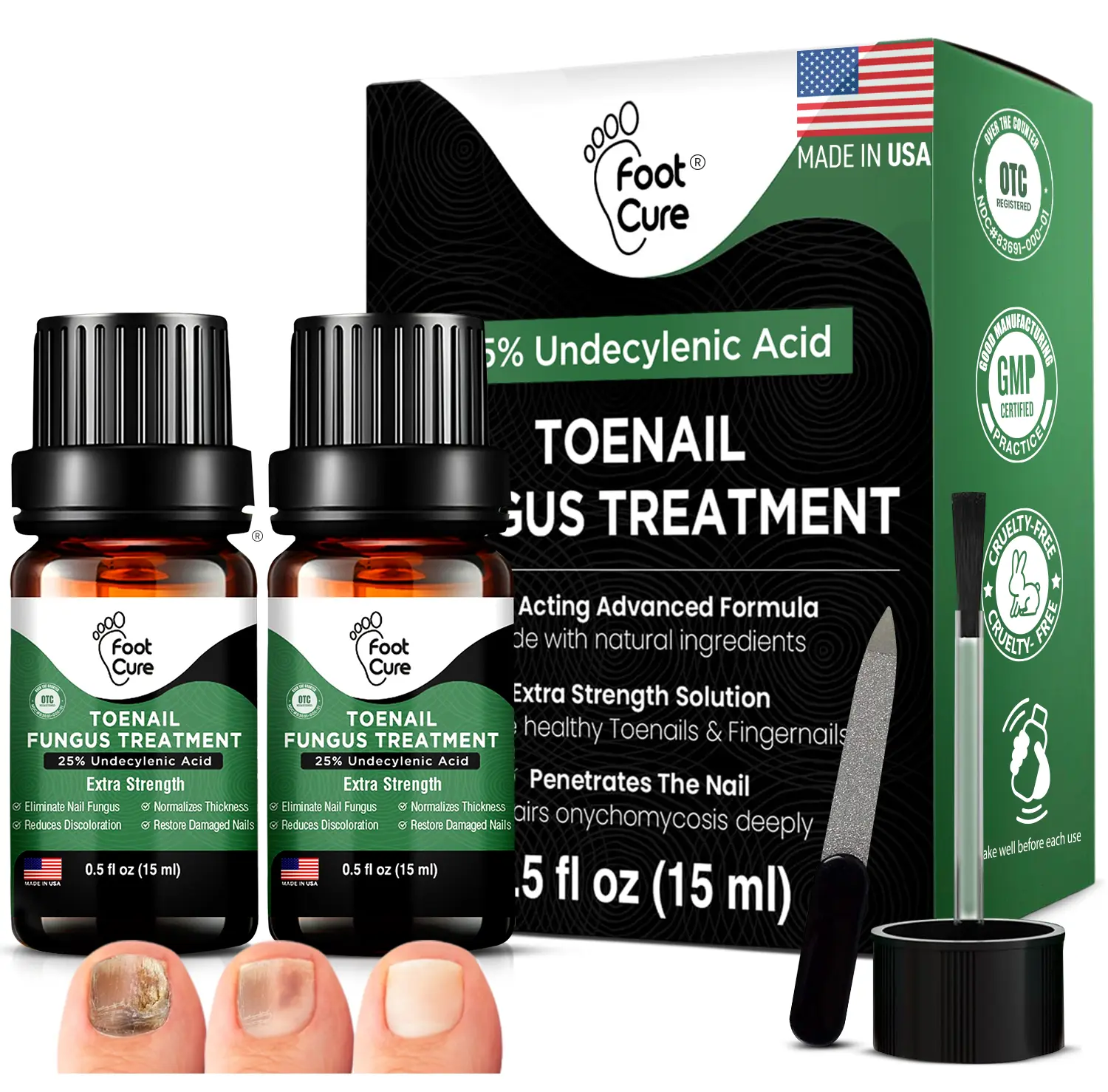 Foot Cure Extra Strength Toenail Fungus Treatment – 25% Undecylenic Acid Antifungal Nail Repair for Yellow, Thick & Ingrown Nails – Softens Damaged Nails on Fingers & Toes – 15 ml