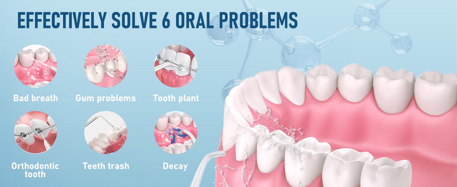 Rechargeable Electric Plaque Cleaner & Flosser with 4 Nozzles – Portable Teeth Cleaning Device for Men & Women, Ideal for Daily Oral Care Cleansing