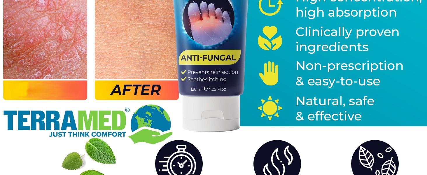 Foot Cream | Athlete’s Foot Cream for Cracked Heels, Dry Skin & Itchy Feet | Relieves Itching, Burning & Redness | Antifungal Treatment Helps with Nail Fungus, Jock Itch & Ringworm | 4.05 fl oz Foot Cream | Athlete’s Foot Cream for Cracked Heels, Dry Skin & Itchy Feet | Relieves Itching, Burning & Redness | Antifungal Treatment Helps with Nail Fungus, Jock Itch & Ringworm | 4.05 fl oz