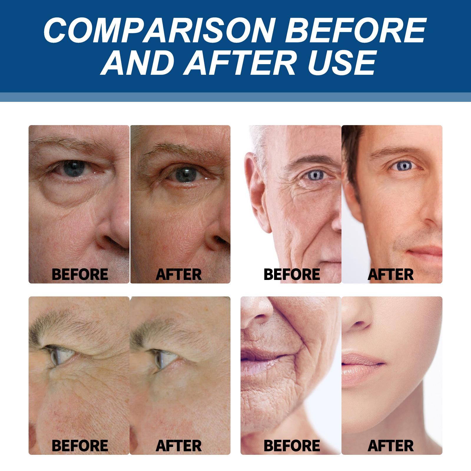 Men's Face Cream Moisturizer - Anti-Aging Cream For Men, Collagen, Retinol & Hyaluronic Acid - Day & Night - Facial Skin Care- Anti Wrinkle Daily Gentle