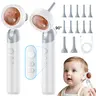 Digital Ear Cleaning Tool with 1.4” IPS LCD Screen, 1080P HD Camera, 5-in-1 Earpick, Rechargeable Battery, LED Flashlight, Photo & Zoom Function, for Adults to Check Ears Nose Mouth Skin, Father’s Day Gift