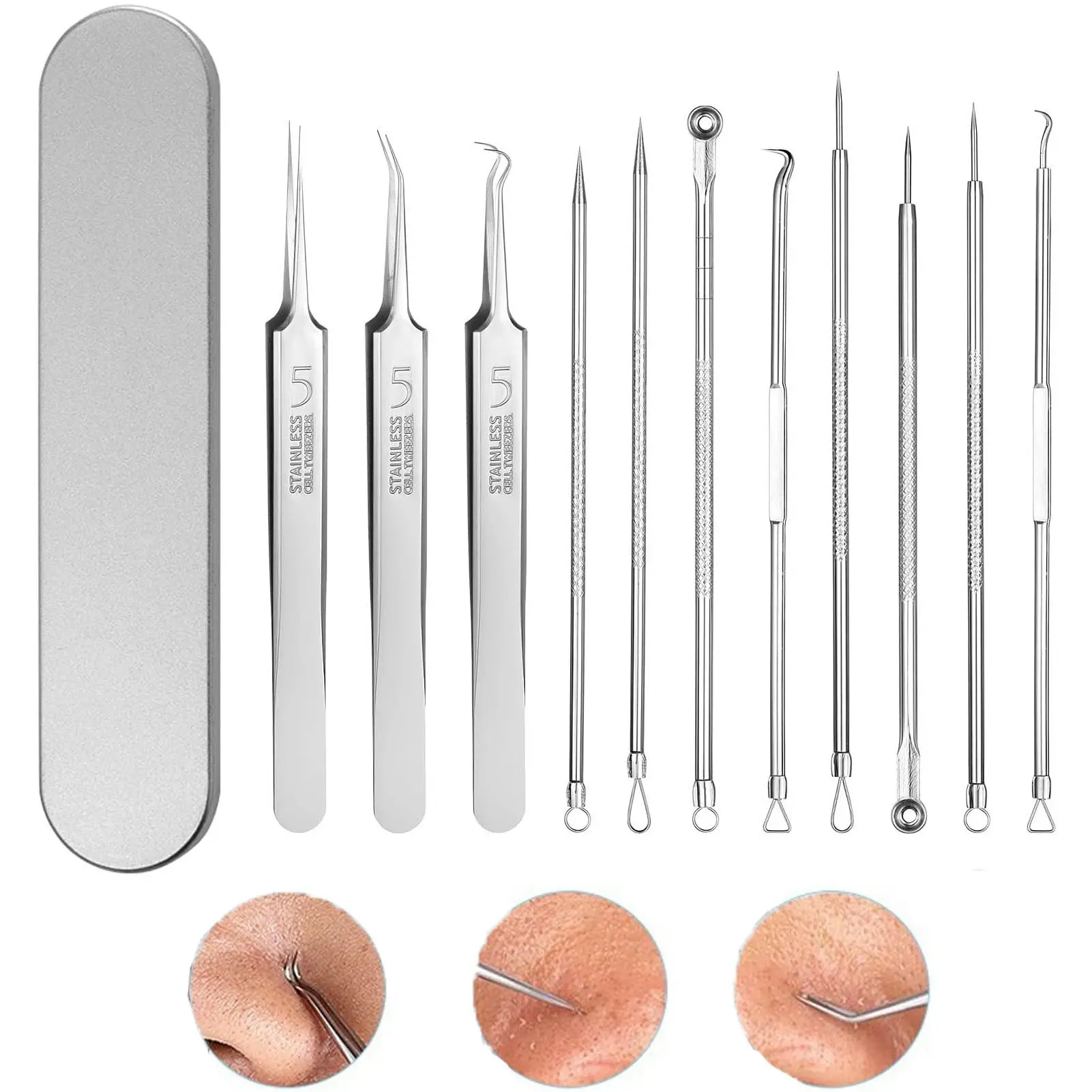 Stainless Steel Acne & Ingrown Hair Removal Kit, Blackhead-Whitehead Extractor Tool for Facial Cleaning, Pimple Needle Set