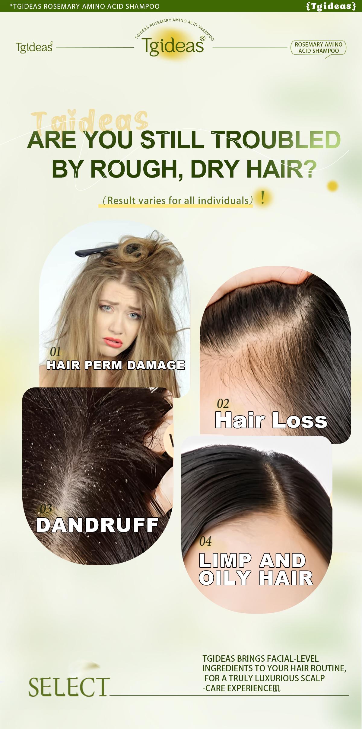 Buy 1 Get 1 Free (Same Model) Tgideas Anti-Hair Fall Hair Loss Treatment Shampoo Oil Control Anti Dandruff Haircare Rosemary Zinc PCA Help Hair Growth Amino Acid Hydrolyzed Protein Repair Reduce Hair Loss Scalp Cleanser Conditioner 250ML Gentle Smoother