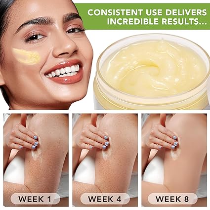 Shea Butter, Shea Butter Raw Organic, Soothes, Nourishes and Softens Dry Skin, Raw & Undefined Shea Butter Suitable for All Skin Types-7.8 oz