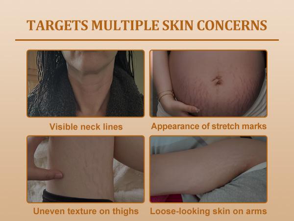 YCZ Neck Firming Cream, Upgraded Formula | Deep Moisturizing for Crepey Skin on Neck, Arms, Thighs & More | Cruelty-Free Skincare