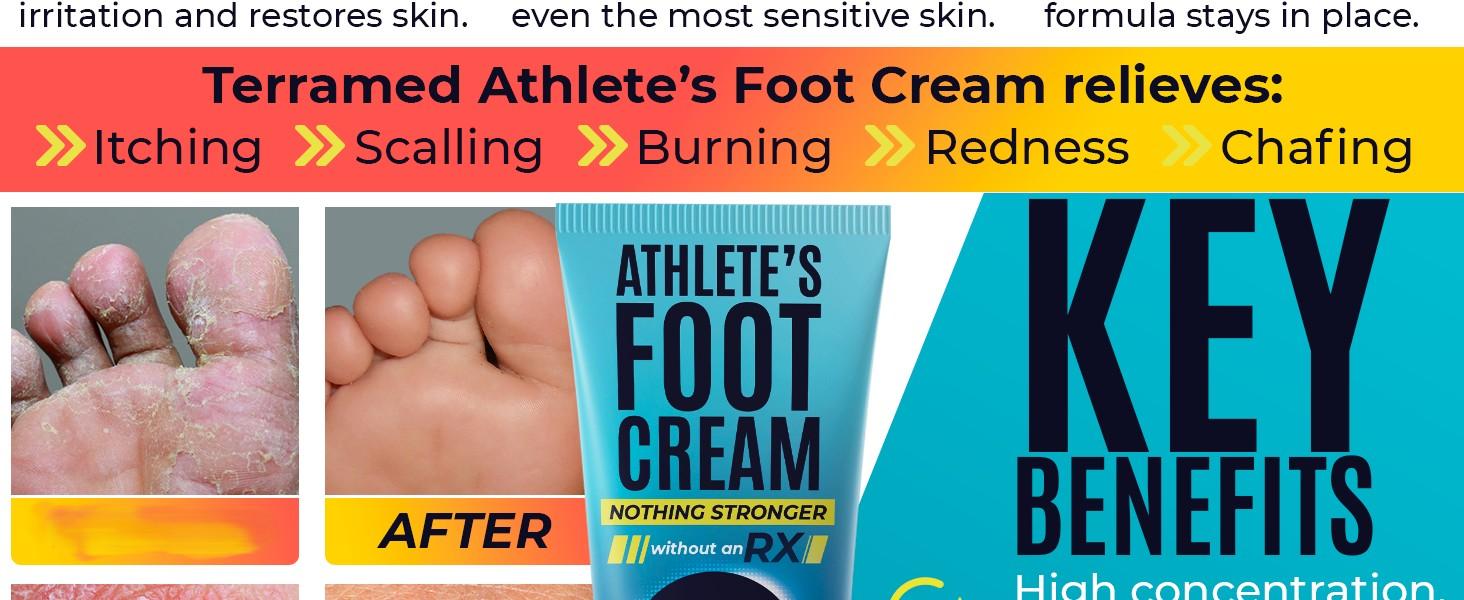 Foot Cream | Athlete’s Foot Cream for Cracked Heels, Dry Skin & Itchy Feet | Relieves Itching, Burning & Redness | Antifungal Treatment Helps with Nail Fungus, Jock Itch & Ringworm | 4.05 fl oz Foot Cream | Athlete’s Foot Cream for Cracked Heels, Dry Skin & Itchy Feet | Relieves Itching, Burning & Redness | Antifungal Treatment Helps with Nail Fungus, Jock Itch & Ringworm | 4.05 fl oz