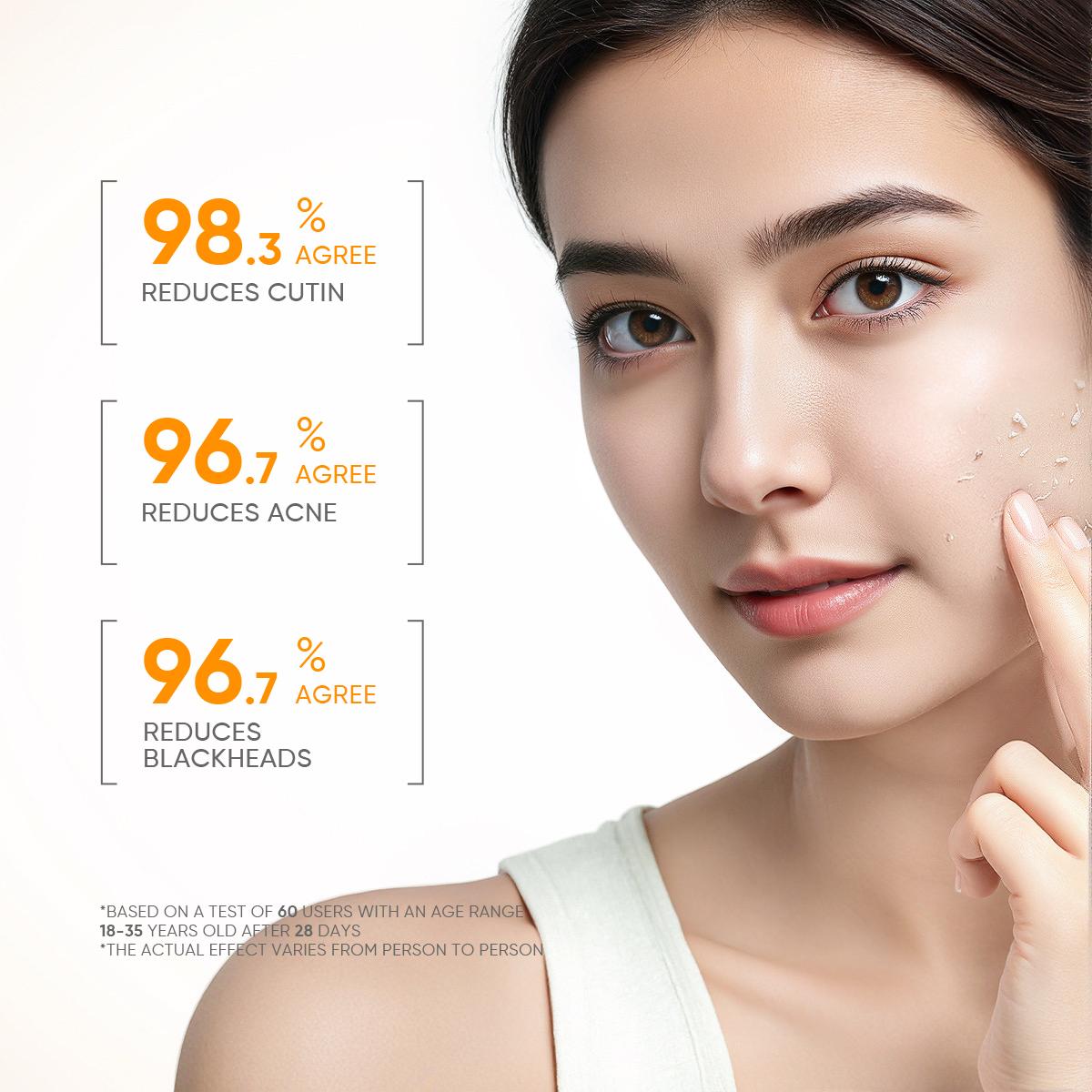 GMEELAN Orange Enzymes Exfoliating Gel 50G LF16-35 French Enzyme Mild Exfoliating Fast Non-Irritating Face Scrubs for All Skin Types GMEELAN Orange Enzymes Exfoliating Gel 50G LF16-35 French Enzyme Mild Exfoliating Fast Non-Irritating Face Scrubs for All Skin Types