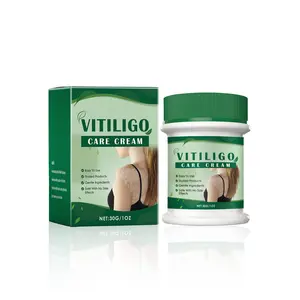 Vitiligo Treatment Cream for White Spots, Hydrating Complexion Balancer with Mint & Aloe Vera to Restore Smooth, Even Skin Tone