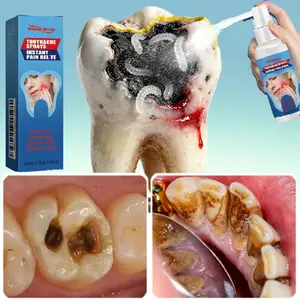 Oral Care Spray 2 – Preventing tooth sensitivity, Relieving swollen and inflamed gums, Helping reduce tooth decay, Gentle formula for daily use
