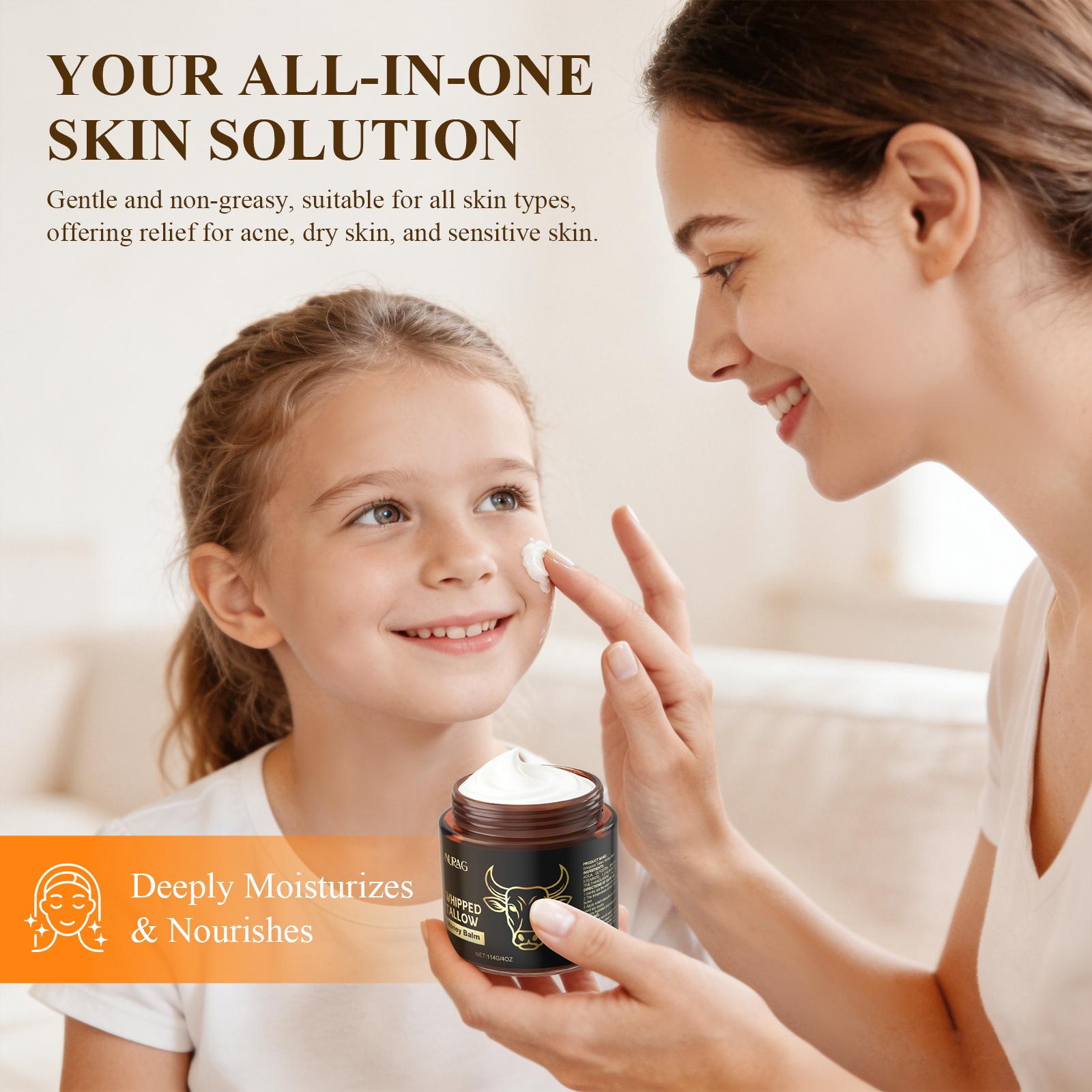 Whipped Grass-Fed Beef Tallow Honey Balm - 4 Oz,Moisturizing Cream for Soft, Smooth Skin - Handmade All-Natural Moisturizer