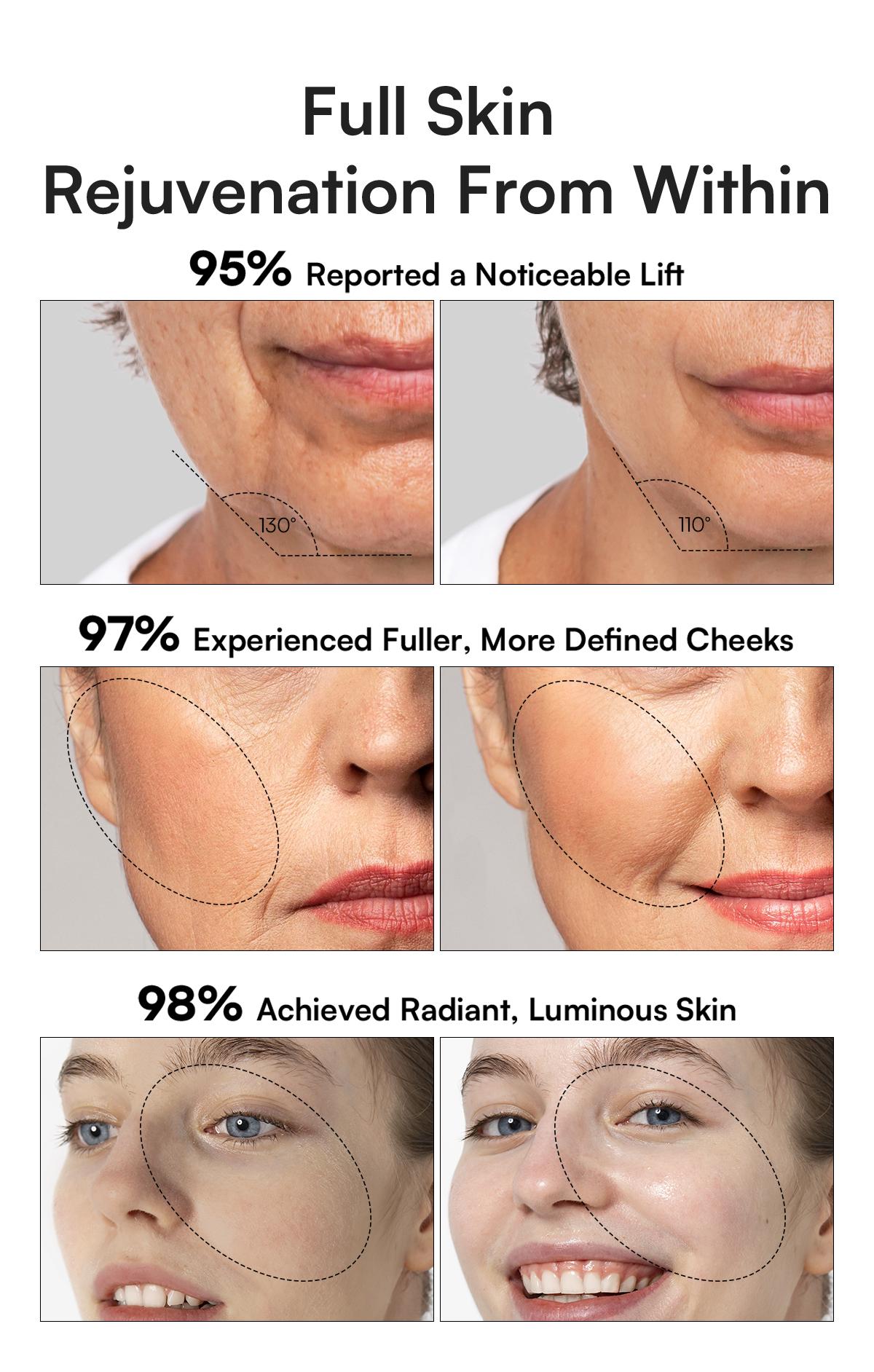 INIA FLARE All-in-One Facial Beauty Device, 3-in-1 Facial Massager Beauty Device for Face and Neck Skin Rejuvenation Lifting/ Tightening/ Infusing, Best Valentine's Day Gift for Her