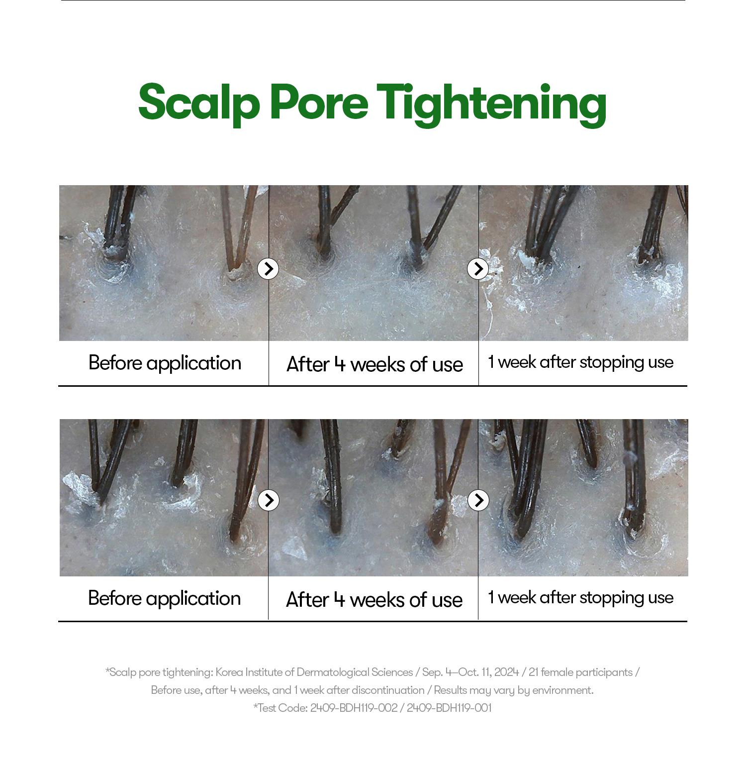 [VT Official] PDRN Reedle Shot Hair Ampoule | Hair Growth Hair loss treatment, Hair Loss Prevention, Scalp Health, OG Liquid Microneedling Reedle Shot, Enhanced Absorption Hair Serum Shot, PDRN & Caffein & Biotin & Rosemary Extract, Anti-aging Scalp No Ri