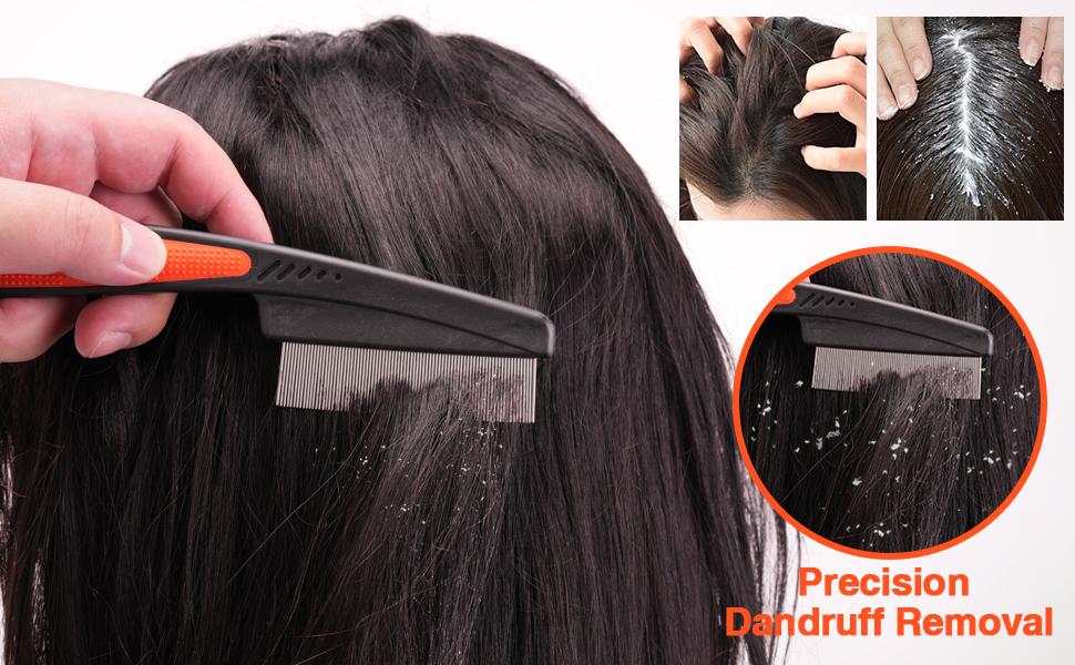 Rosemary Oil for Hair Growth & Dandruff Comb - Stainless Steel Fine Tooth Comb for Split Ends, Dry Scalp & All Hair Types Flakes Boost Shine Rosemary Oil for Hair Growth & Dandruff Comb - Stainless Steel Fine Tooth Comb for Split Ends, Dry Scalp & All Hair Types Flakes Boost Shine