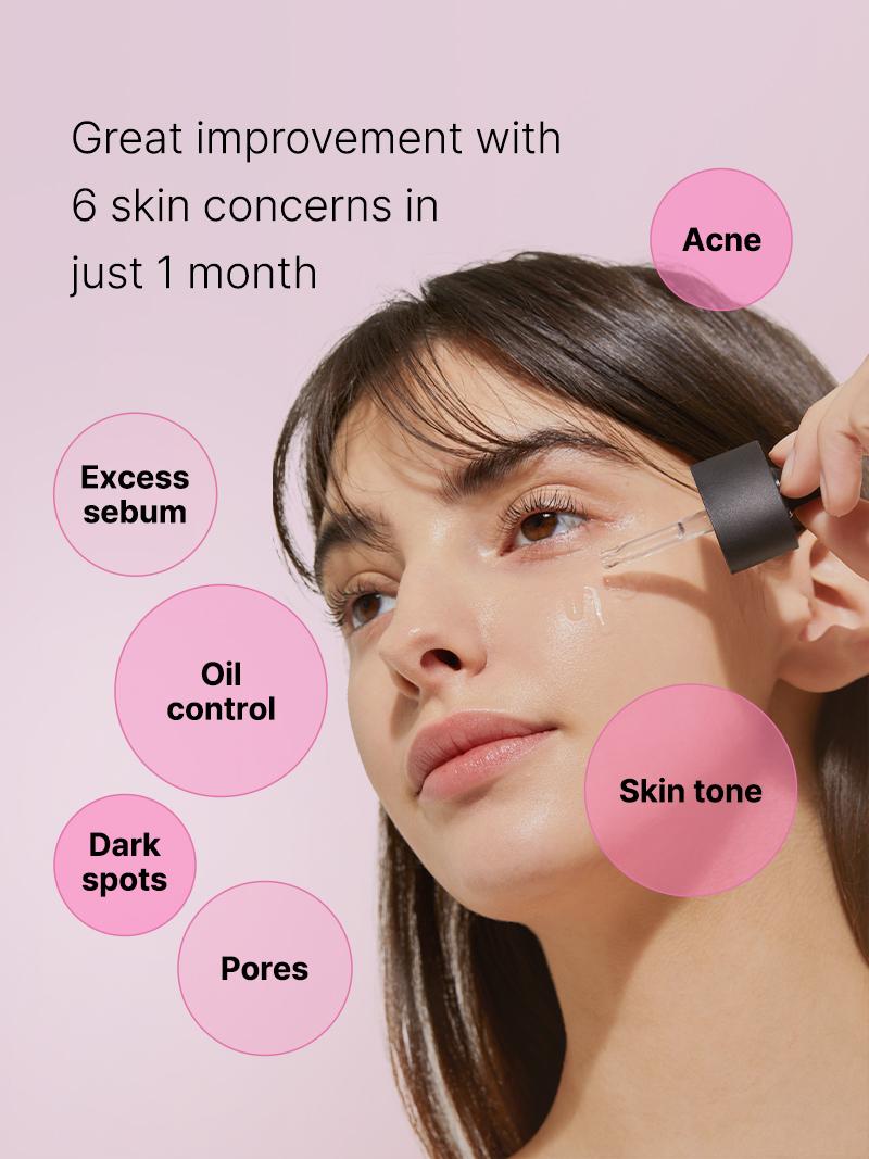 [COSRX Official] The Niacinamide 15 Serum 20ml - Reduces Oily Skin, Shrinks Pores & Refines Skin Texture for Korean Glass Skin, Poreless Face, Skincare