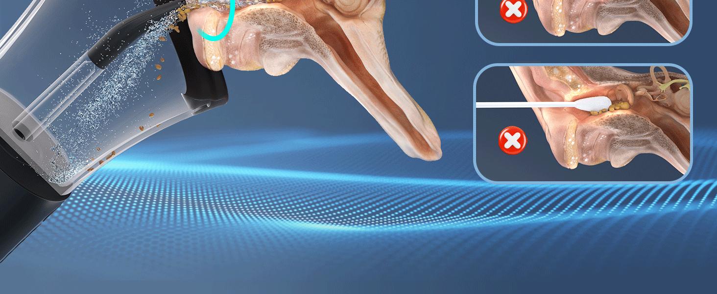 Morfone Ear Wax Removal Kit with 400Ml Waste Tank Effective Safe Ear Cleaner USB-C Water Temperature Sensor 360° Spray 4 Modes IP67 Waterproof Halloween Party Gift