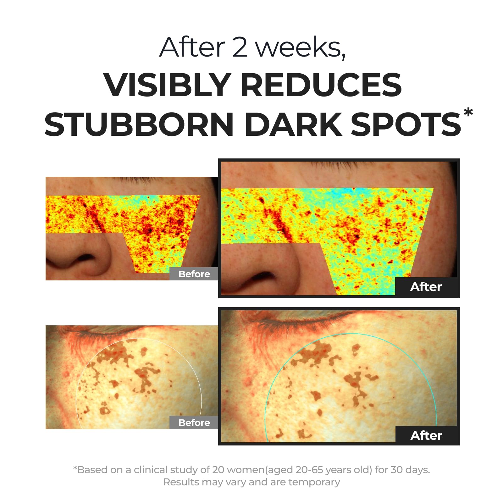 DOMINAS Hyper P-Toning Serum with Niacinamide & Tranexamic Acid for Dark Spot Reduction 30ml Korean Skin Repair