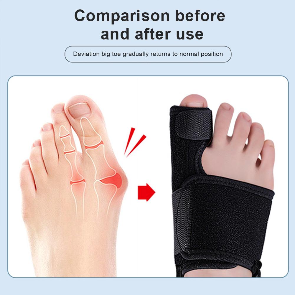 Adjustable Toe Alignment Support - Orthopedic Corrector for Hallux Valgus & Bunion Comfort with Posture Improvement