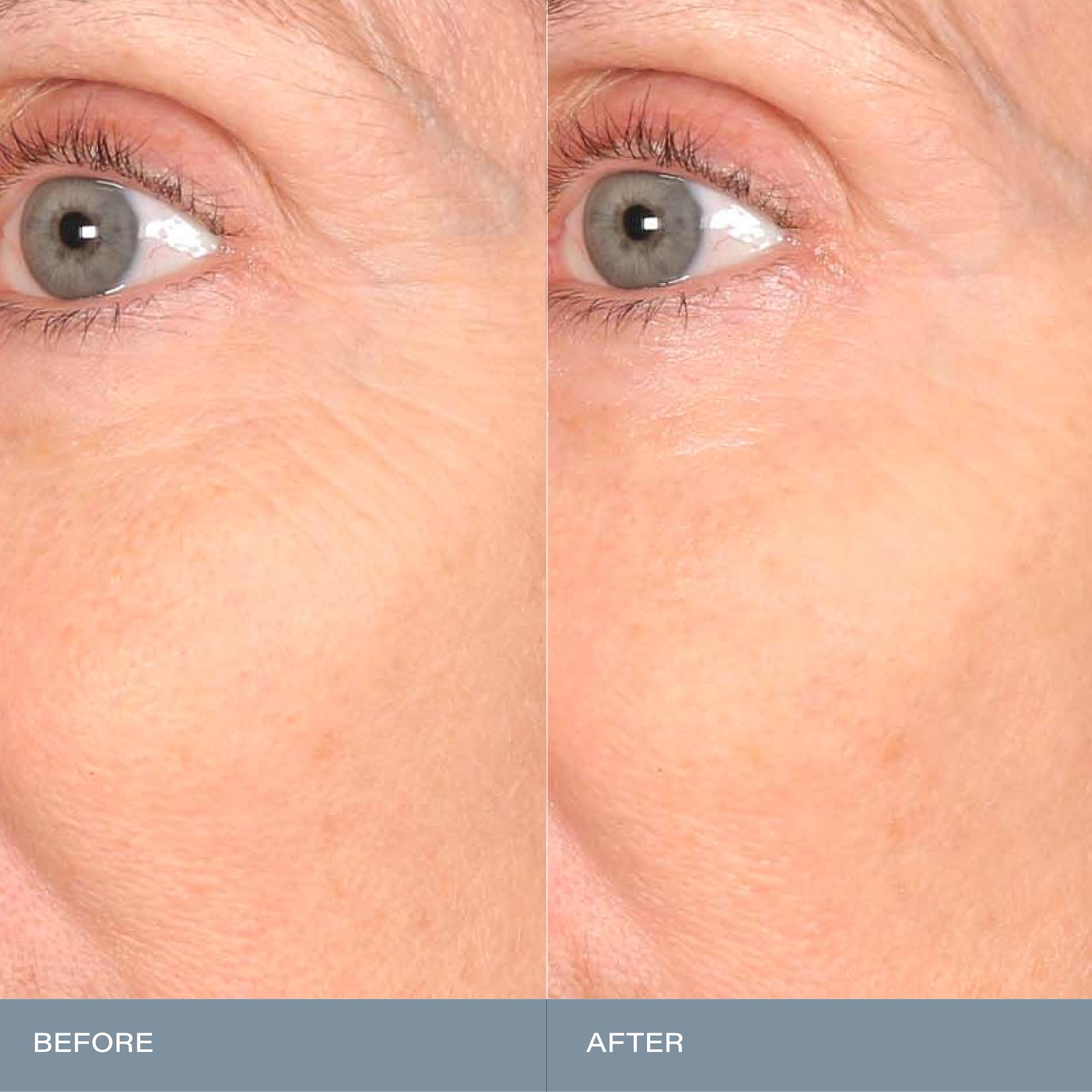 SKINN Cosmetics: Mantle Milk Skin Repair 100 Hours of Hydration - Moisture-Supporting Serum for Enhanced Hydration and Barrier Care Moisturizer Milky