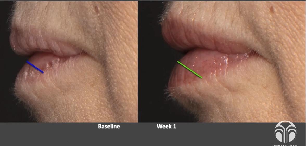 Nu Colour Peptide Pout Lip Plumping Gloss - Makeup Cosmetic Waterproof Volume