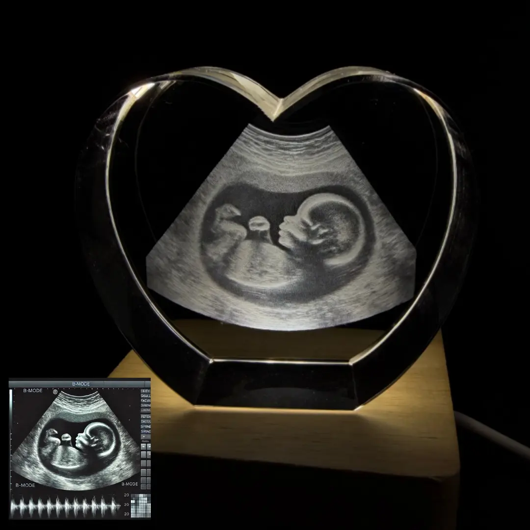 YIYINYING Crystal Personalized Photos: Ideal as personalized gifts for women, wives,  husbands, grandmothers, babies，pets. Birthday, wedding, commemoration，Anniversary  Mother's Day Gift