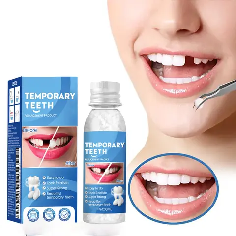 Home Use Shapeable Denture & Teether Resin Gel Kit - 30ml Dental Glue, Film, Temporary Fillings for Adults, Fake Teeth Gaps & Broken Teeth Repair