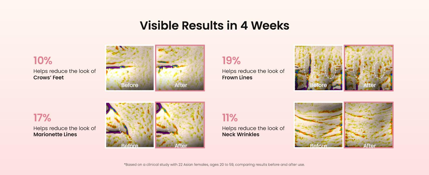 [Biodance Official] Collagen Peptide Eye Patch | Anti Wrinkle Patches for Face & Smile Line Patches, Under Eye Mask for Fine Lines, Eye Bags & Wrinkles, Korean Skin Care (60ea)