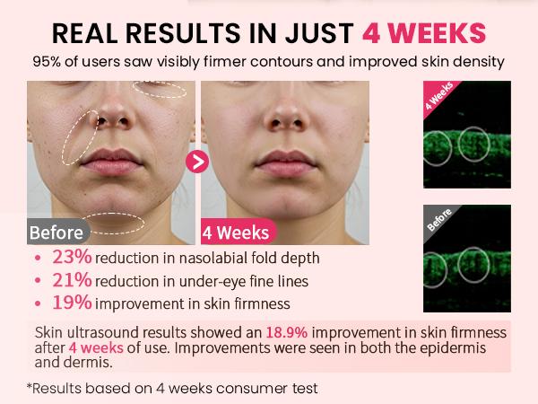 Skin Tightening Device for Face & Neck - Red Light Therapy Wand to Boost Collagen - Electric Facial Sculpting Tool for Fine Lines & Firmness